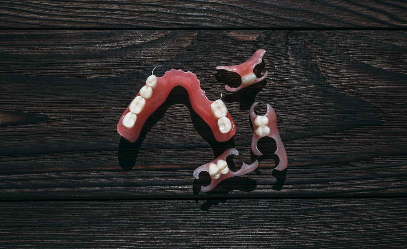 Immediate Dentures: Understanding Bone Resorption During Healing
